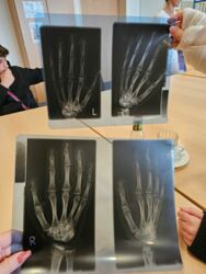 Schüler begutachten Röntgenbilder im WKK Heide